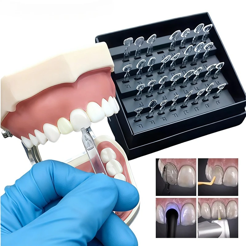 Teeth Whitening Moulds - Dental Mould Kit For Composite Resin