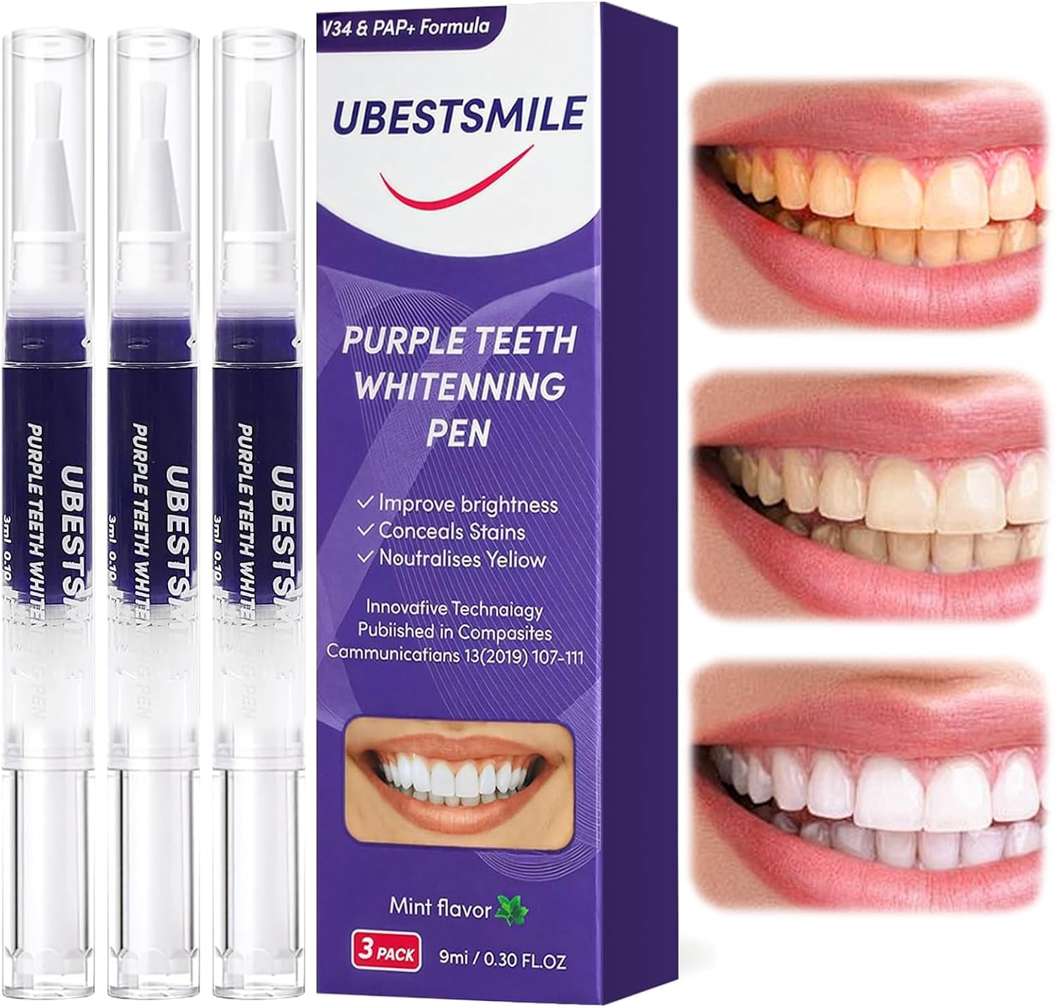 UBESTSMILE V34&PAP+ Formula Pu - огляд і ціна Teeth Whitening Pens