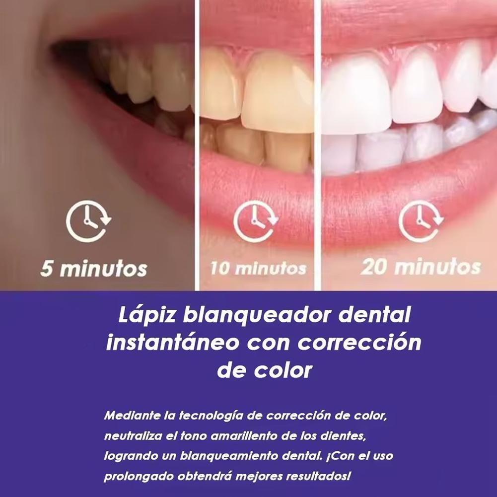 UBESTSMILE V34&PAP+ Formula Pu - огляд і ціна Teeth Whitening Pens
