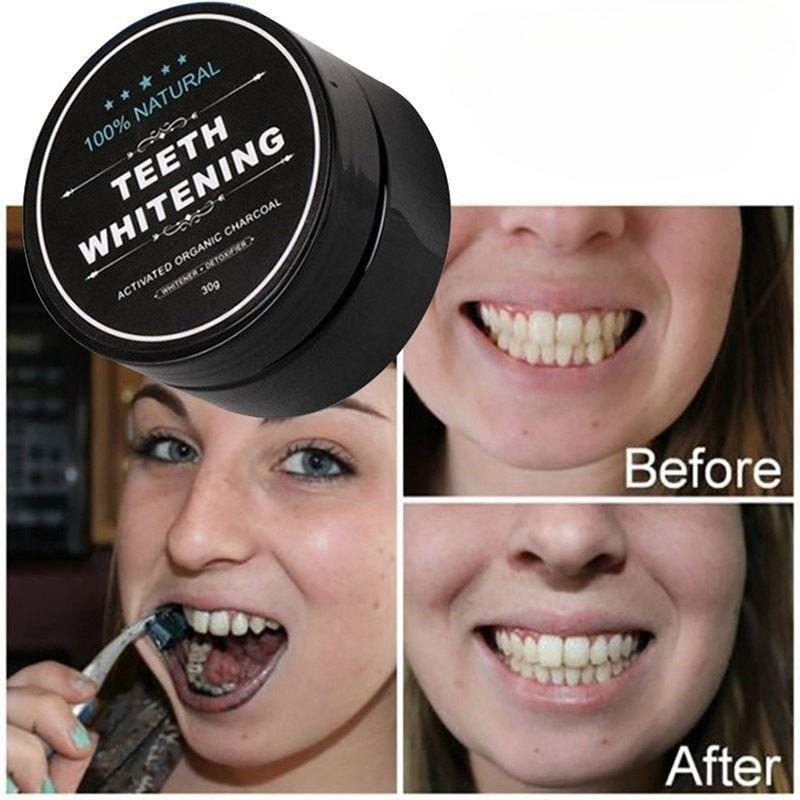 1 Box Activated Charcoal Teeth - огляд і ціна Teeth Whitening Near Me